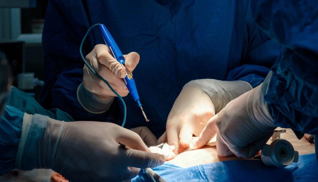 electrosurgery procedure singapore