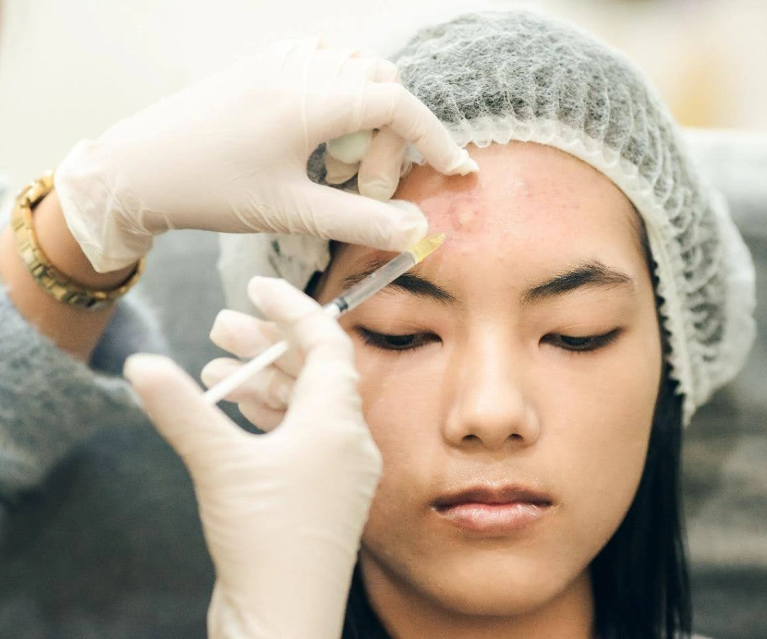 how pimple injections work.