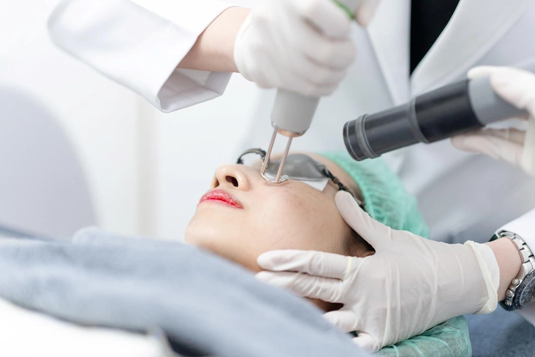 pigmentation laser treatment Singapore.