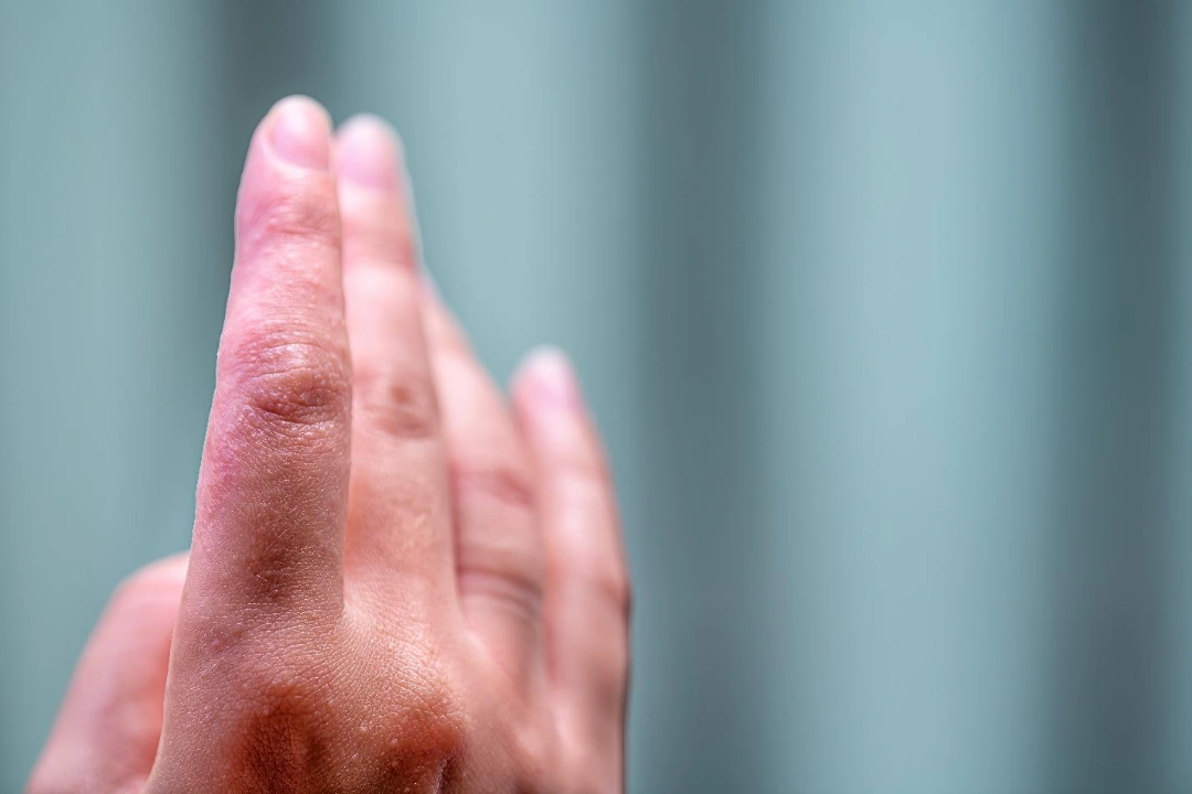 what causes skin infection.