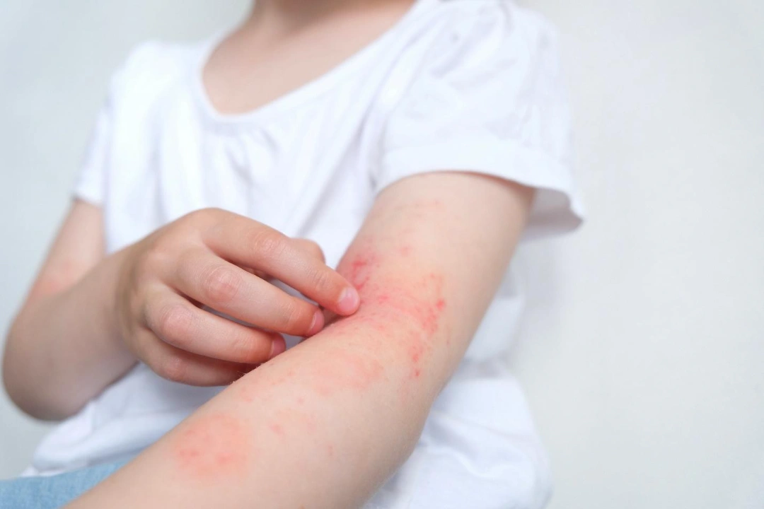 symptoms of skin infection.
