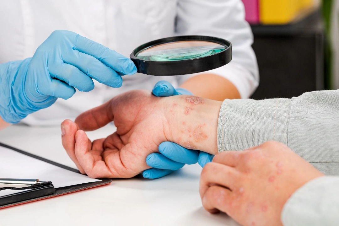 diagnosing skin infection.