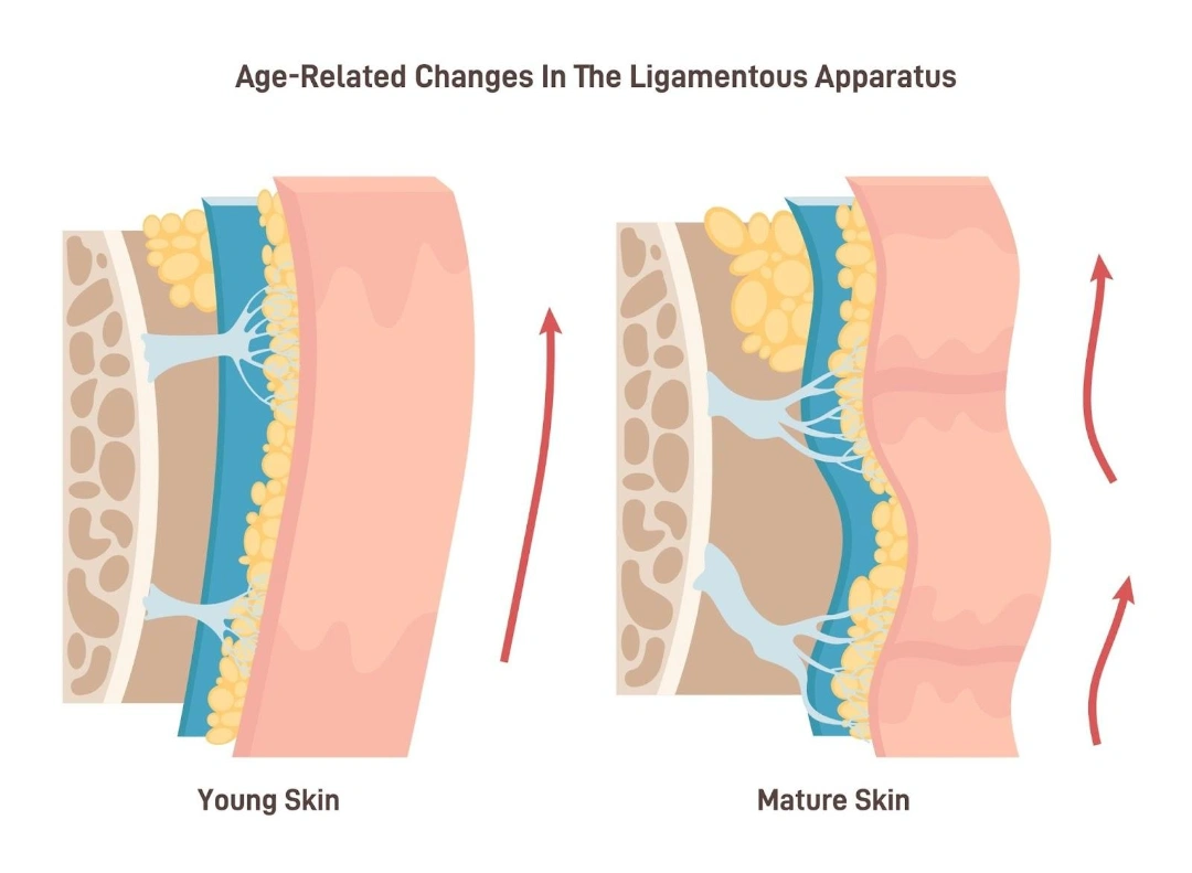 Causes of Wrinkles Singapore