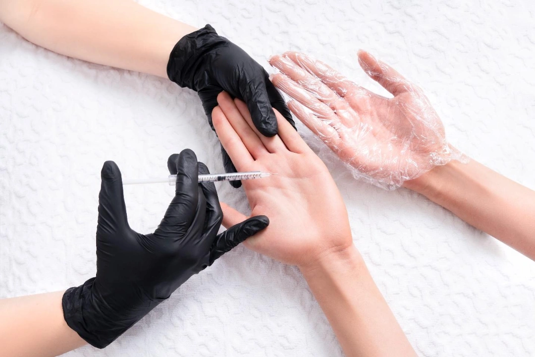 botox hyperhidrosis