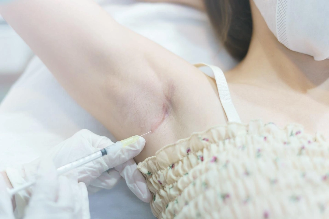 how often can I get steroid injections