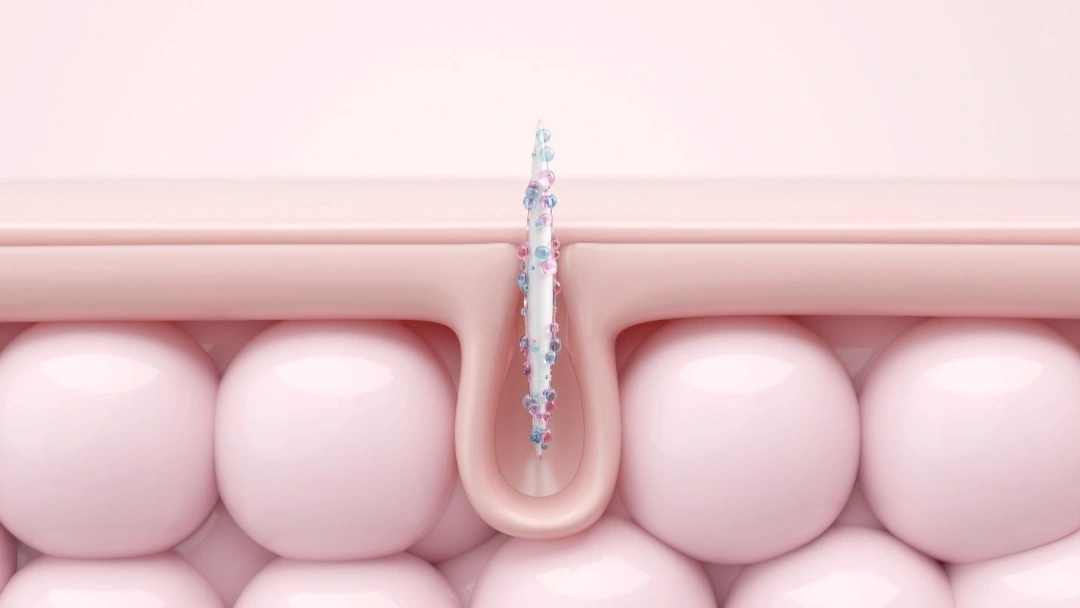 microneedling collagen renewal.